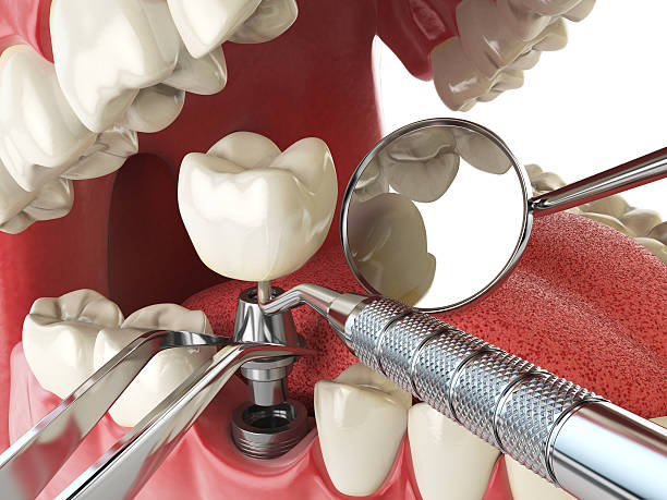 Urgent Tooth Repair in NM